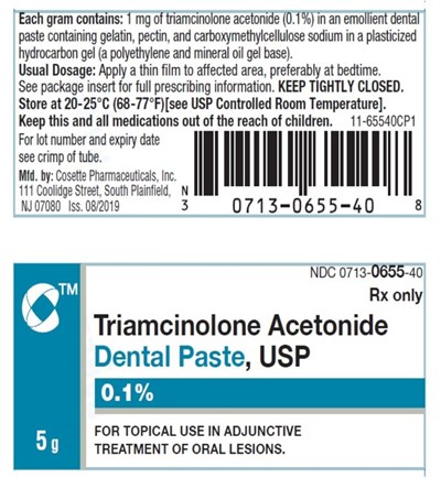 Triamcinolone Acetonide Dental Paste-3 - Triamcinolone Acetonide Dental Paste 3